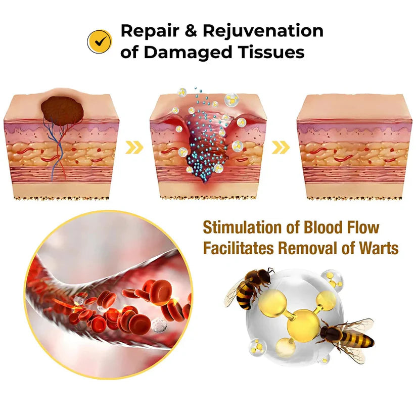 Derma Smooth Skin Tag Removal Patch - 72 Patches