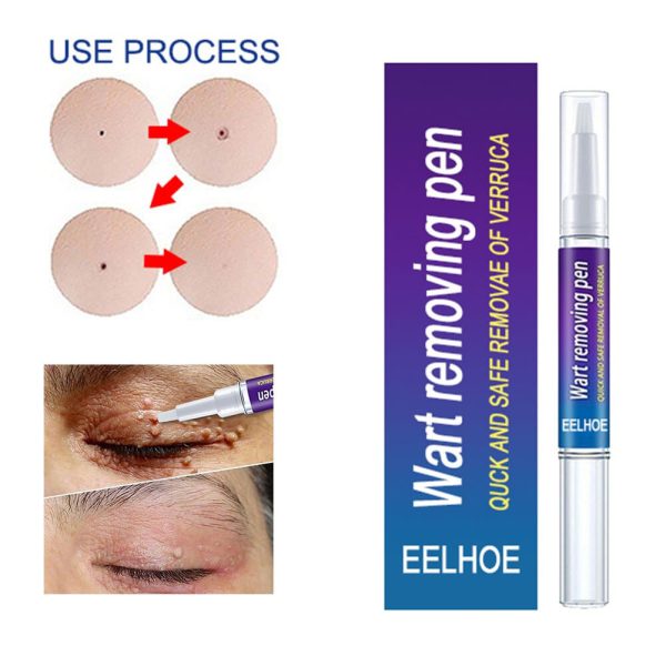 Wart Remover Gel Pen